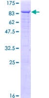 Human MEN1 / Menin Protein (Recombinant GST)