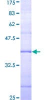 Human G3BP2 Protein (Recombinant GST, N-terminus)