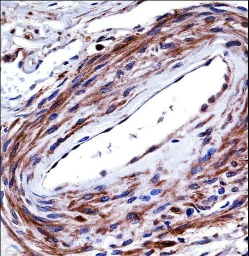 P2RX5 / P2X5 Antibody (aa325-353)