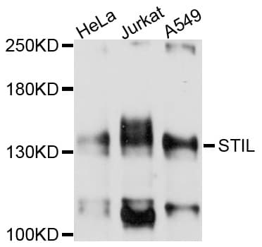STIL Antibody
