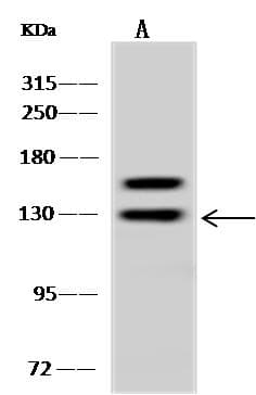 Polyclonal Rabbit anti-Human ARHGAP4 Antibody (WB)