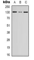 DGK-IOTA / DGKI Antibody (C-Terminus)