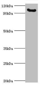 Polyclonal Rabbit anti-Human MCPH1 Antibody (aa536-835, IHC, WB)