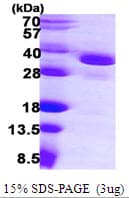Human EIF2B1 Protein (Recombinant His)