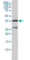 MAGEA2 Antibody (clone 1H4)