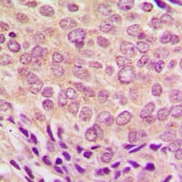 PRKCA / PKC-Alpha Antibody (C-Terminus)