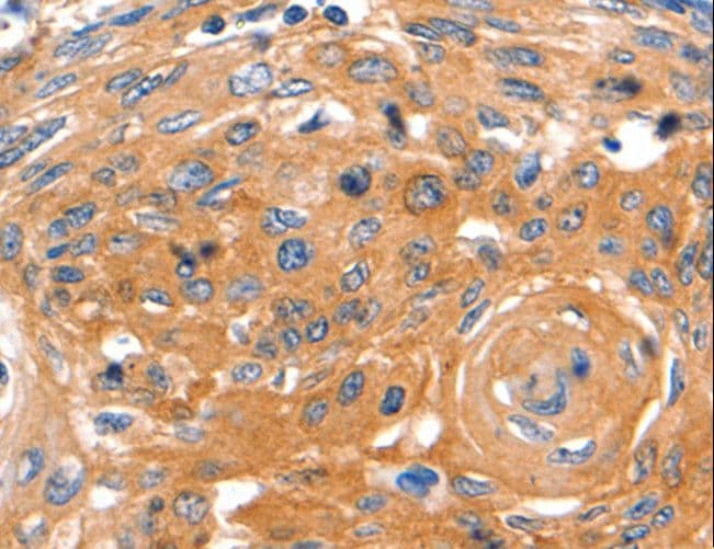 CAP2 Antibody