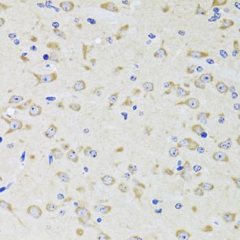 YWHAZ / 14-3-3 Zeta Antibody