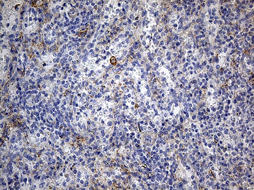 DBN1 / Drebrin Antibody (aa2-240, clone OTI4G4)