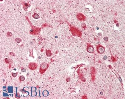 IHC-plus™ SEC13 Antibody (aa270-320)