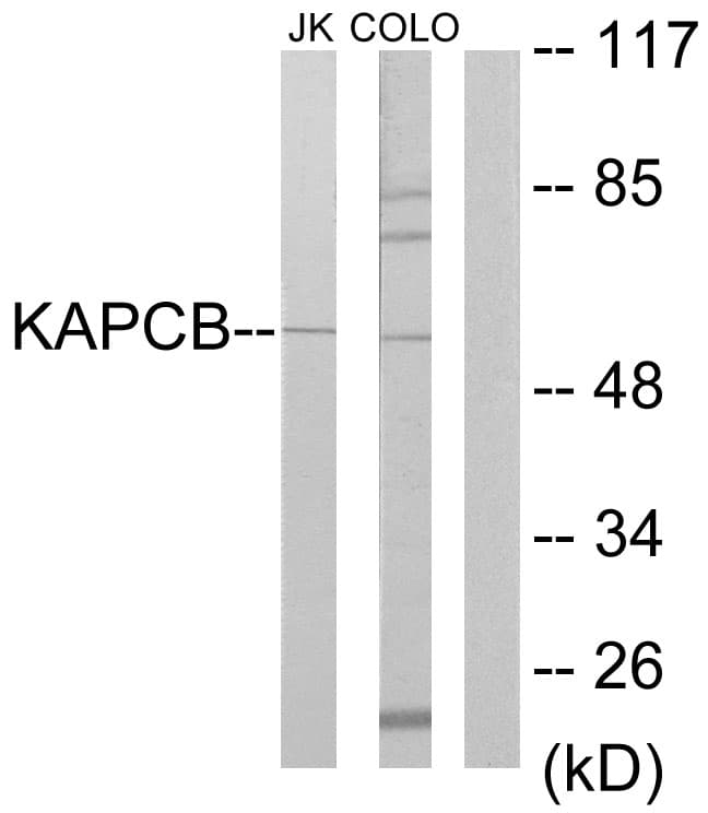 PRKACB Antibody (aa291-340)