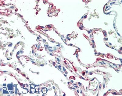 Polyclonal Rabbit anti-Human MIP2 / GRO2 / CXCL2 Antibody (aa34-107, IHC, WB)