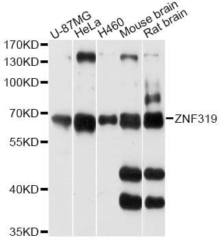 Polyclonal Rabbit anti-Human ZNF319 Antibody (WB)