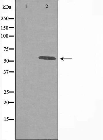 Polyclonal Rabbit anti-Human ITPKA Antibody (IF, WB)