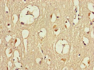 Polyclonal Rabbit anti-Human DMXL2 Antibody (IHC, IF)