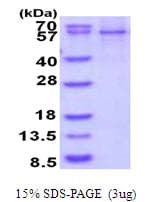 Human AKT1 Protein (Recombinant His)