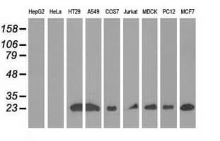 RIT2 / RIN Antibody (clone OTI3F4)