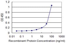 ERBB2 / HER2 Antibody (clone 4E1)