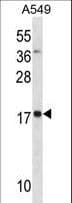 Polyclonal Rabbit anti-Human MYL4 Antibody (aa1-30, WB)