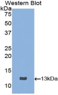 CSTB / Cystatin B / Stefin B Antibody (aa1-98, APC)