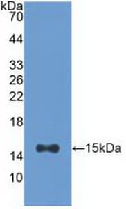ACO1 / Aconitase Antibody (aa458-586, PE)