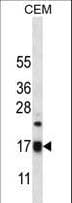 Polyclonal Rabbit anti-Human MRPS12 / RPSM12 Antibody (aa28-59, IHC, WB)