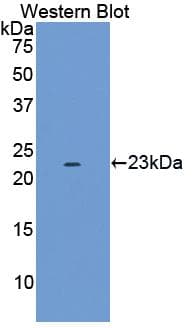EGFR Antibody (aa319-484, APC)