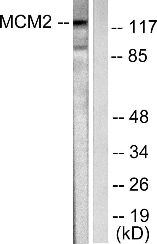 Polyclonal Rabbit anti-Human MCM2 Antibody (IHC, IF, WB)