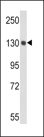 CP / Ceruloplasmin Antibody (aa547-577)