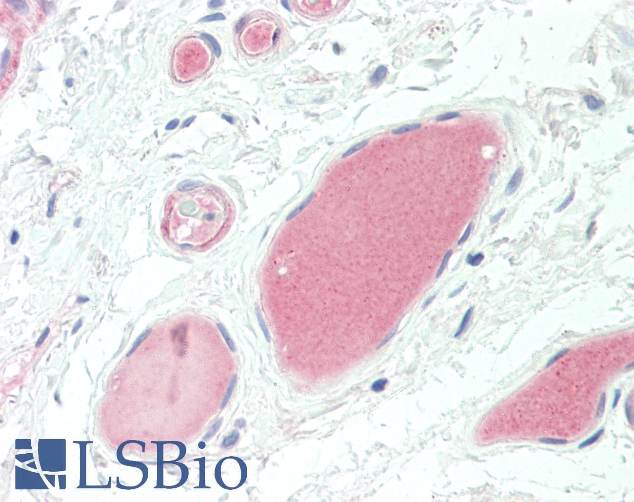 IHC-plus™ Complement C3d Antibody (clone E28-P)