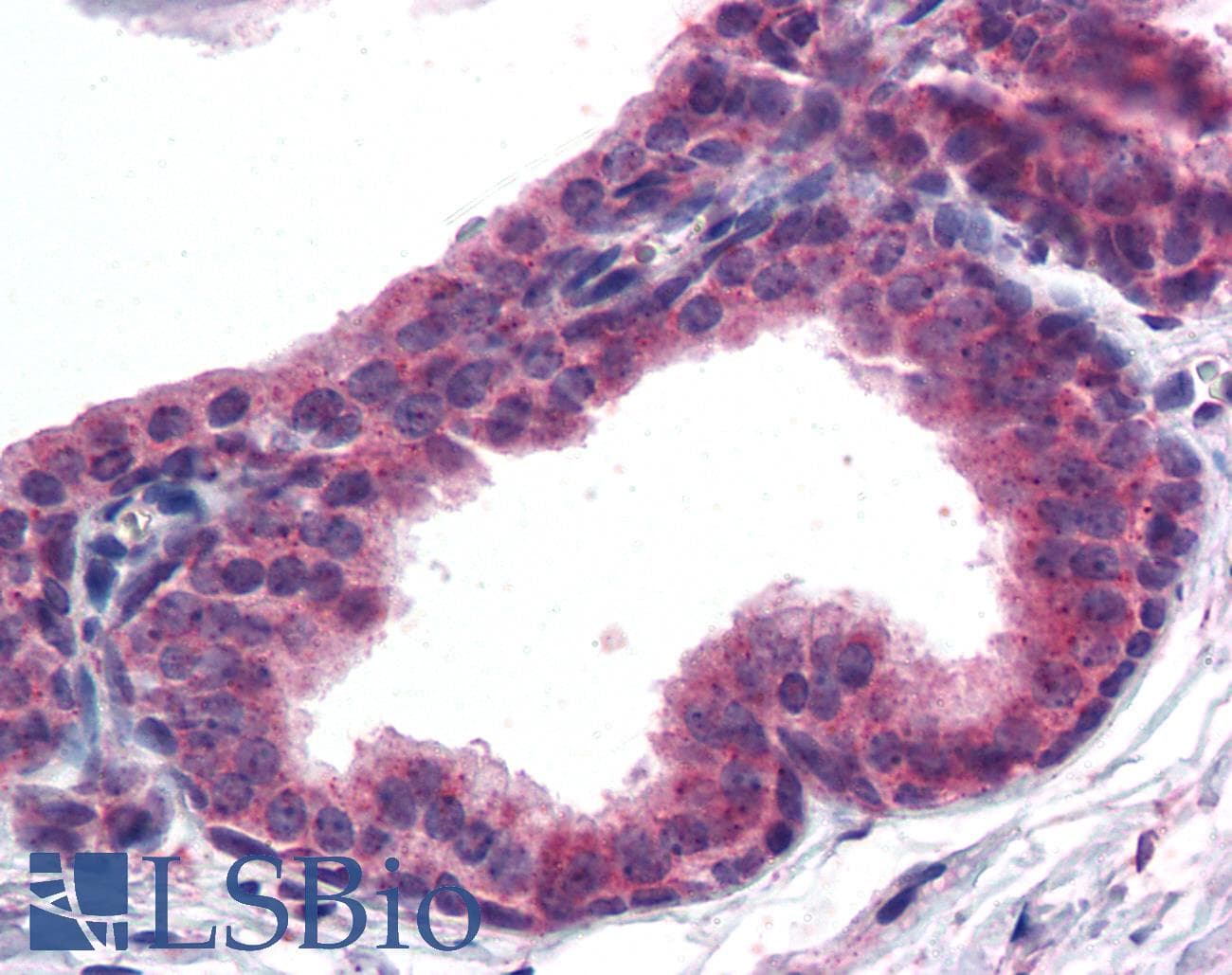 IHC-plus™ AKT3 Antibody (aa119-133)