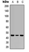 Polyclonal Rabbit anti-Human CD121b / IL1R2 Antibody (Internal, WB)