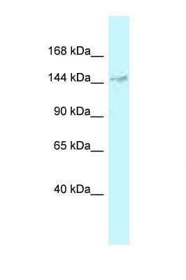 Polyclonal Rabbit anti-Human DHX38 Antibody (aa465-514, WB)