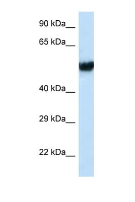 IFT74 / CCDC2 Antibody (C-Terminus)