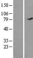 MISP / C19orf21 Protein (Over-Expression Lysate Myc-DDK (Flag))
