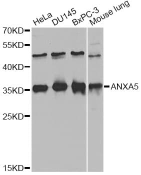 ANXA5 / Annexin V Antibody