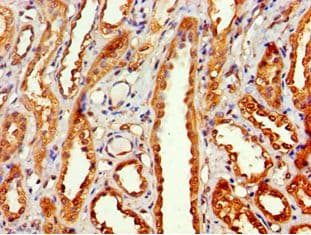 Polyclonal Rabbit anti-Human MTMR14 Antibody (aa1-280, IHC, WB)
