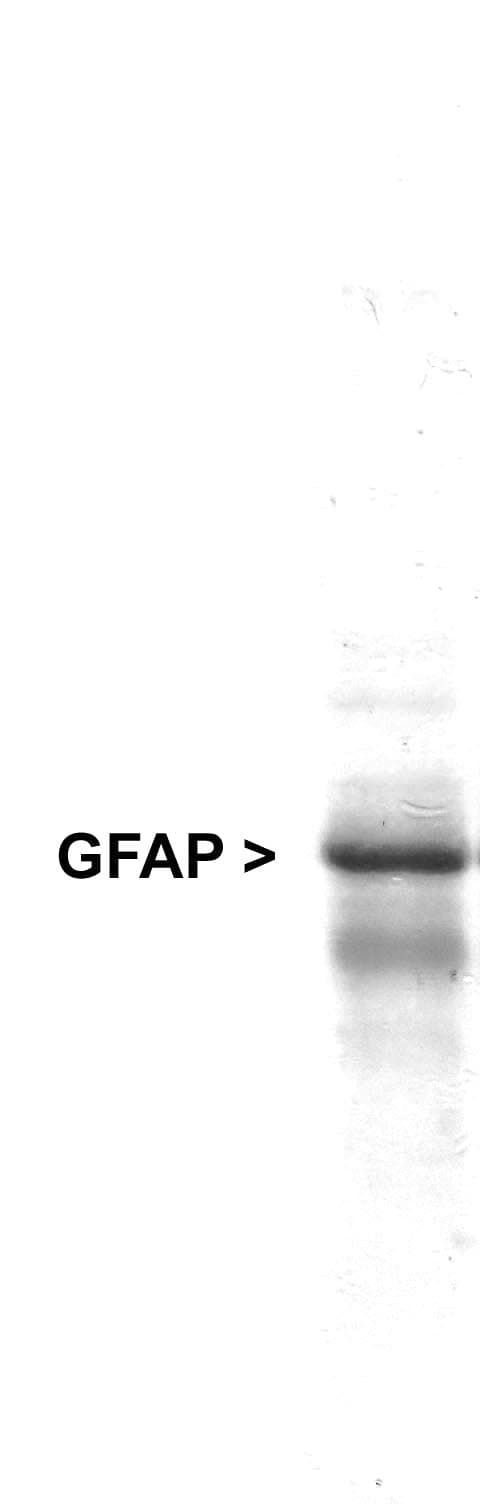 GFAP Antibody