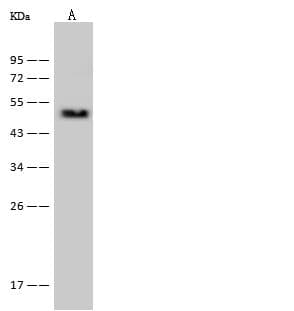 Polyclonal Rabbit anti-Human PSMC2 / RPT1 Antibody (IHC, WB)
