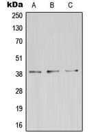 ZDHHC9 Antibody (C-Terminus)