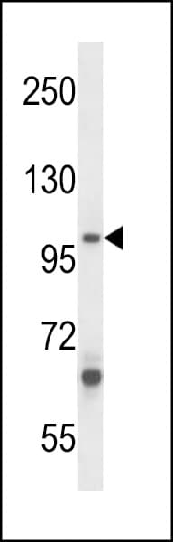 Polyclonal Rabbit anti-Human ZC3H12B Antibody (aa615-644, WB)