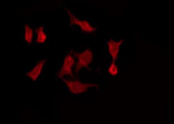 RRP22 / RASL10A Antibody