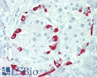 IHC-plus™ N6AMT1 Antibody (aa1-186)