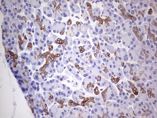 Monoclonal Mouse anti-Human KRT19 / CK19 / Cytokeratin 19 Antibody (clone OTI5F4, aa240-390, IHC, WB)