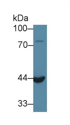 ACP6 Antibody (PE)