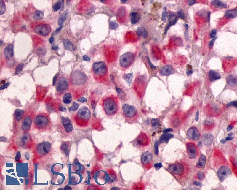 PathPlus™ ADGRG2 / GPR64 Antibody (C-Terminus)