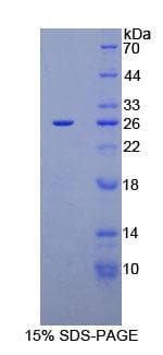 Human MUC16 / CA125 Protein (Recombinant His-S)