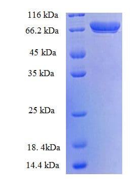 Human TGM2 / Transglutaminase 2 Protein (Recombinant His-SUMO)