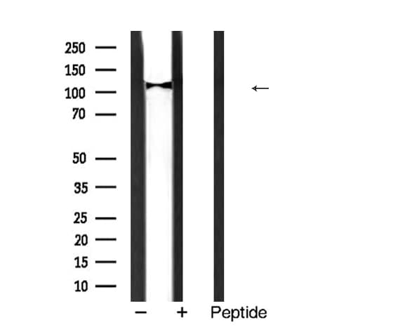 Polyclonal Rabbit anti-Human PPP1R12A / MYPT1 Antibody (IHC, WB)