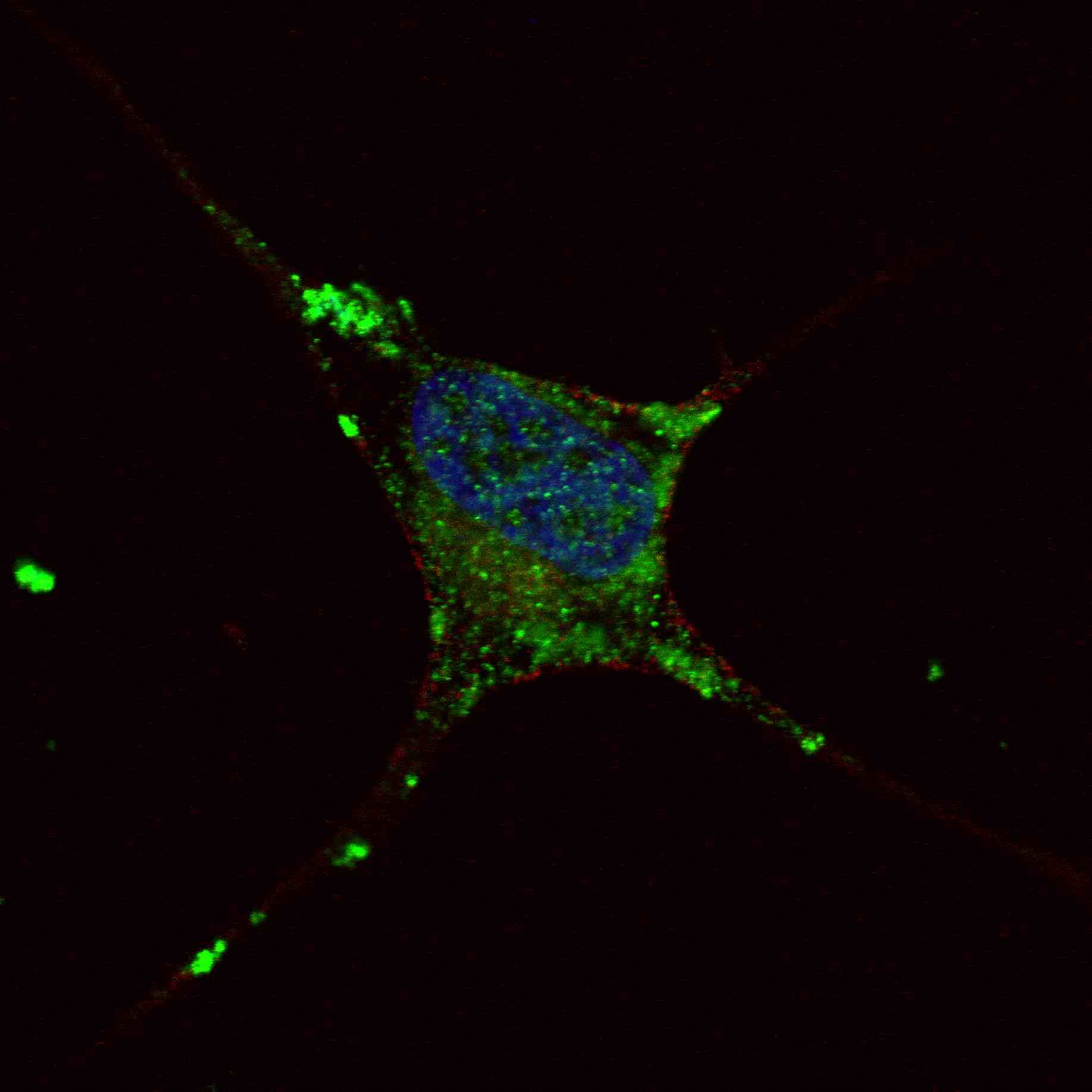 ELP2 / STATIP1 Antibody (aa737-765)